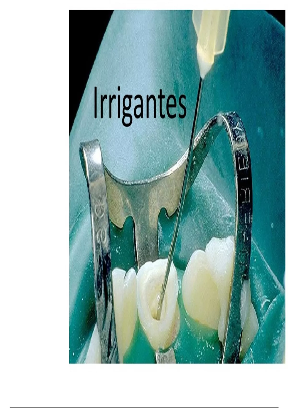 IRRIGANTES En Endodoncia Presentación - Odontología () - Stuvia US