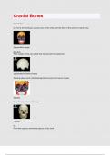 Cranial Bones exam question and answers latest update 