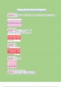 Basic Dysrhythmia-Relias Exam Latest 2024/2025