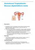 Gestational Trophoblastic Disease (Hydatidiform mole).