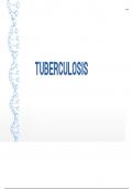 Tuberculosis - A complete view