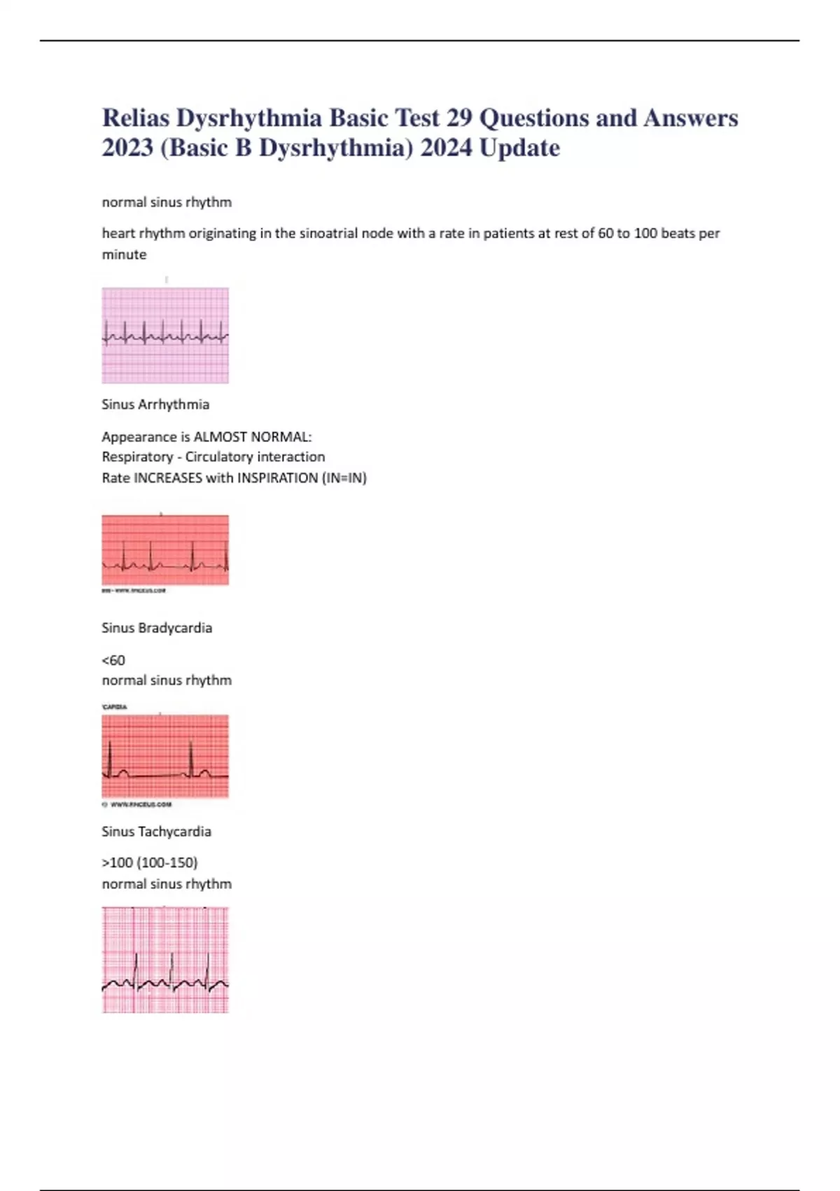 Relias Dysrhythmia Basic Test 29 Questions And Answers 2023 (Basic B ...