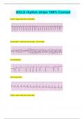 ACLS rhythm strips 100% Correct