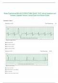 Relias Dysrhythmia/RELIAS DYSRHYTHMIA BASIC TEST with all Questions and  Answers (Updated Version) (Actual Exam from Recent Exam)