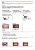 Gebitsontwikkeling: Samenvatting alle college's, 10 tentamenvragen! Samenvatting boek gebitsontwikkeling en handout occlusie en articulatie