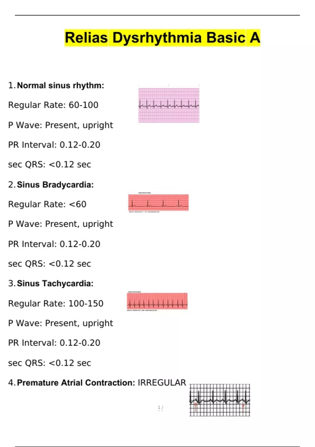 Relias Dysrhythmia Basic A Questions And Verified Answers (2024 / 2025 ...
