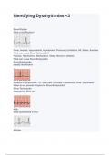 Identifying Dysrhythmias _3 with complete solution