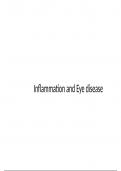 Summary -  Inflammation in eye disease 