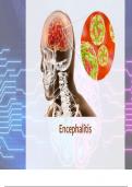Encephalitis.pptx with complete solution