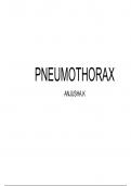 PNEUMOTHORAX