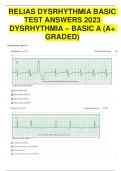 Relias Dysrhythmia Basic Test Answers 2023 Dysrhythmia – Basic A ( A+ GRADED 100% VERIFIED