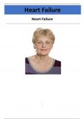 Heart Failure case study JoAnn Smith