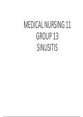 Sinusitis (Medicine II)