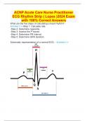 ACNP Acute Care Nurse Practitioner ECG Rhythm Strip ( Lopes )2024 Exam with 100% Correct Answers