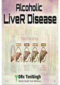 Alcoholic liver disease