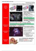 patologias del cordon umbilical en el tercer trimestre