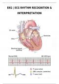 EKG | ECG RHYTHM RECOGNITION  AND INTERPRETATION 