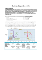 Systematiek van elektrocardiogram (ECG) beoordelen