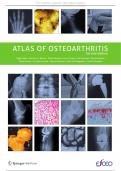 ATLAS OF OSTEOARTHRITIS Nigel Arden • Francisco J. Blanco • Olivier Bruyère • Cyrus Cooper • Ali Guermazi • Daichi Hayashi  David Hunter • M. Kassim Javaid • Francois Rannou • Jean-Yves Reginster • Frank W. Roemer  Second edition