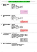 Relias Dysrhythmia Basic Test 2024