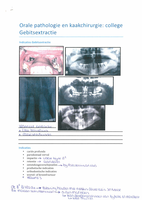 College Orale pathologie en kaak: Gebitsextractie en afwijkingen van het kaakbot.