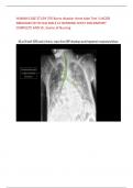 HUMAN CASE STUDY 376 Burns disaster chest tube Test 3 JACOB ABRAHAM 58 YR OLD MALE CC BURNING CHEST DISCOMFORT COMPLETE AND VE, Exams of Nursing