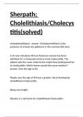 Sherpath; Cholelithiasis Cholecystitis(solved)