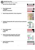 2024 RN EKG TEST PREP EXAM WITH CORRECT ANSWERS