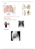 Imaging of Respiratory Disease