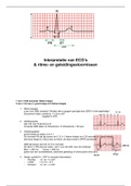 ECG beoordelen en overzicht ritme- en geleidingsstoornissen