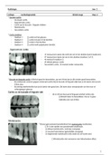 stap 2 radiologie cariësdiagnostiek 