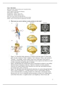 case 1 the brain