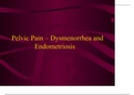 2022/2023) complete solution 1. Cervical cancer presentation  Pathology   2. Vaginal disorders including: vaginitis and bartholin cysts  Bartholin's Duct Cyst and Abscess Clinical Findings Treatment Uterine Fibroids (Leiomyomas) Vaginitis Candidiasis E