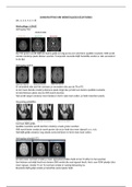 Samenvatting MRI werkcolleges, zelfstudies periode 2.2
