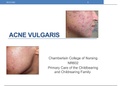 NR 602 WEEK 2 PEDIATRIC GRAND ROUND PRESENTATION AND DISCUSS ; ACNE VULGARIS