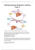 Voeding en Diëtetiek hoofdfase 1 periode 3 samenvatting Pathofysiologie Diabetes Mellitus type 1