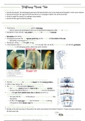 5. Patterning Neural Tube