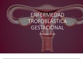 Enfermedad Tofoblastica gestacional