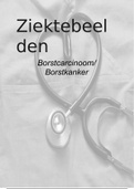 borstkanker