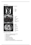 MRI P5 en P6