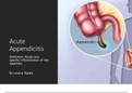 Anatomy - Appendicitis 