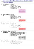 Relias Dysrhythmia Basic A Exam Newest 2024 With Reliable  Answers,Upgraded