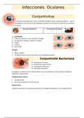 Infecciones Oculares