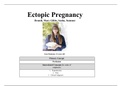 Ectopic Pregnancy Case Study