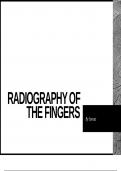 Lecture notes Introduction to Radiography of the Hand   Clark's Position Radiography