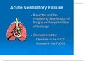 Acute Alterations in Respiratory Function Technologies, NURS 425 (2021), Latest Questions and Answers with Explanations, All Correct Study Guide, Download to Score A