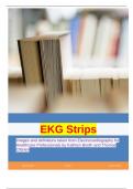 EKG Strips Images and definitions taken from Electrocardiography for Healthcare Professionals by Kathryn Booth and Thomas O'Brien