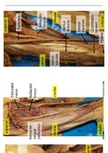 Dissecties onderste en bovenste lidmaat 