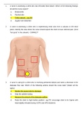 MedSurg1   ATI Fundamentals Exam | 100 Questions and Answers | LATEST 2020 / 2021