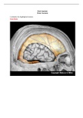 BIO 1500 brain_anatomy_Worksheet (William Paterson University)